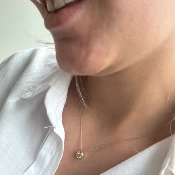 Dentevim Ağız ve Diş Sağlığı Polikliniği Dolgu Düşmesi Ve Verilen Sözün Tutulmaması