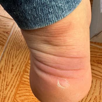 Sneaks Up Mağazasının İnsan Sağlığını Hor Gören Garanti Anlayışı!