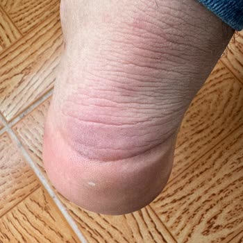 Sneaks Up Mağazasının İnsan Sağlığını Hor Gören Garanti Anlayışı!