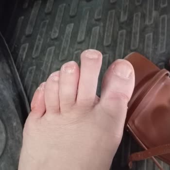 Mangonun Ürün Sorumluluğunu Almaması Mağduriyeti