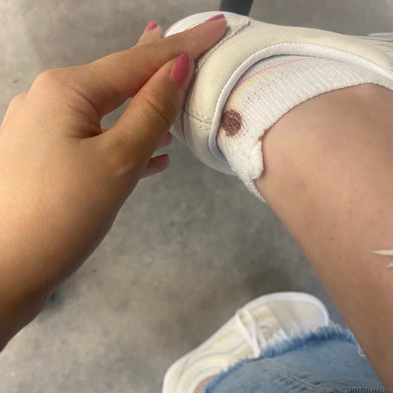 Vans Ayakkabı Vans Dan Dolayı Ayağımın Haline Bakın