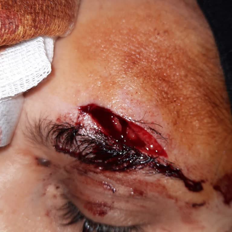 Medicabil Hastanesi Plastik Cerrahı Sorun