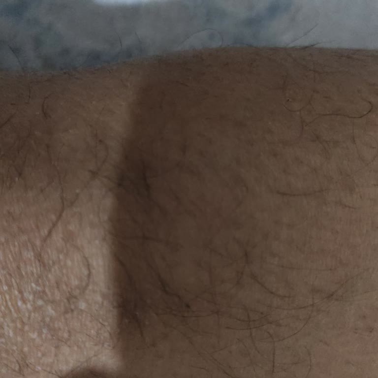 Adven Vip Güzellik Merkezi (Çukurambar) Lazer Konusunda Vaatler Gerçekleşmedi