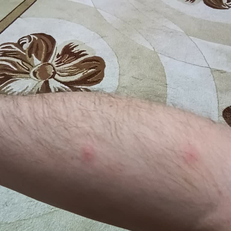 Antalya Büyükşehir Belediyesi Haşere İlaçlama Yardımcı Olur Musunuz