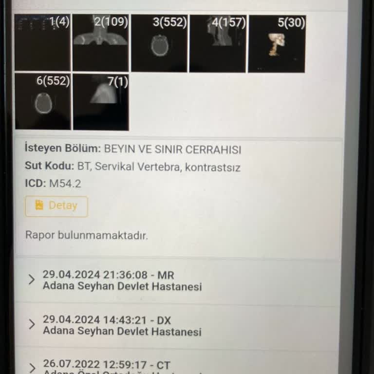 Adana Şehir Hastanesi Rapor Sonucu İçin Hastanın Ölmesini Bekliyor