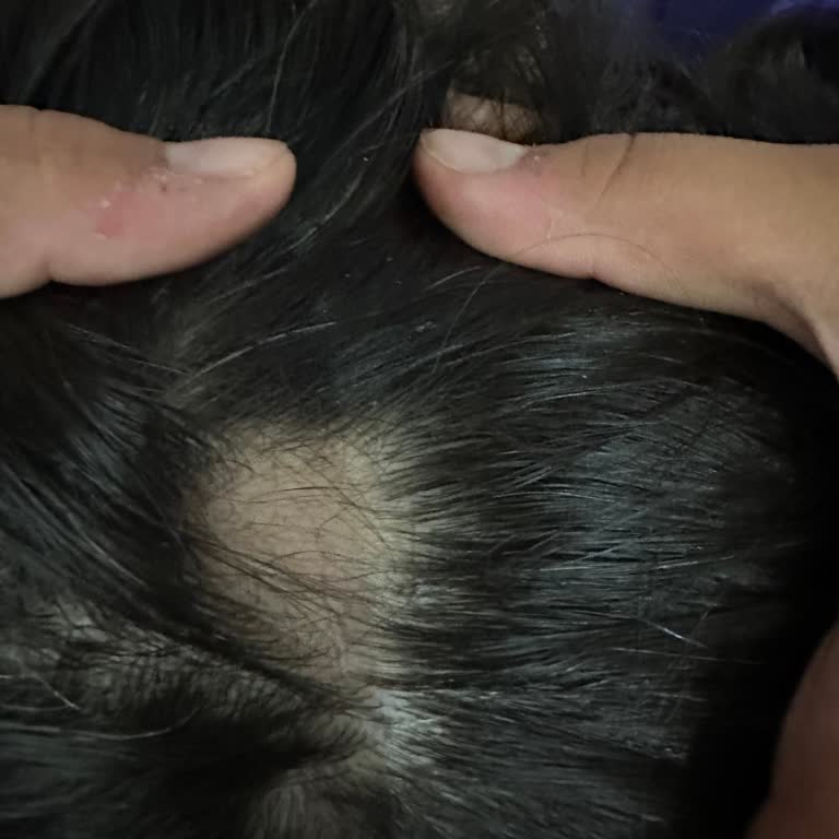 Проблема выпадения волос от шампуня Yves Rocher