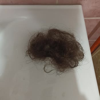 Bioxcin Saç Döküp Kepek, Kaşıntı Yaptı