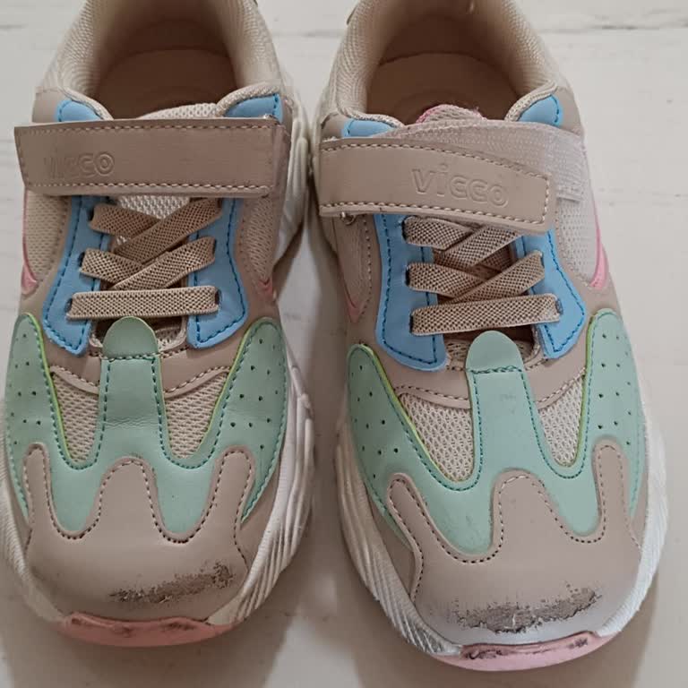 Vicco Ayakkabı Derisinde Soyulma