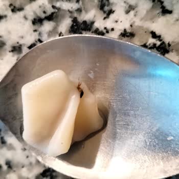 BİM Mantı Haşare Çıktı