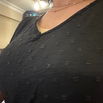 Little Visqon Defolu Ürün Değişim Sıkıntısı