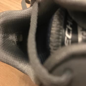 Skechers Kronik Topuk Yırtığı Problemi