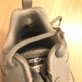 Skechers Kronik Topuk Yırtığı Problemi