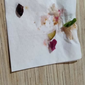Komagene Dürüm İçinden Yenmiş Zeytin Çekirdeği Çıktı