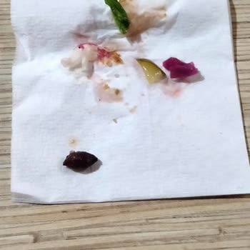 Komagene Dürüm İçinden Yenmiş Zeytin Çekirdeği Çıktı