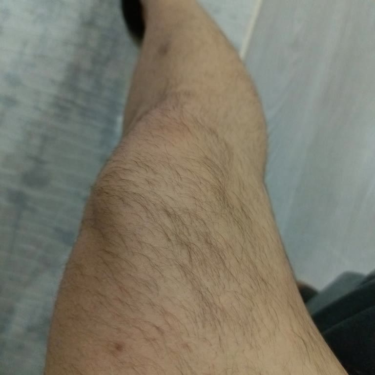 Mardin Dilan Polat Şubesinden Memnun Değilim!