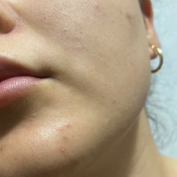 SHE Vec Glyc-Alright Toniği Bozuldu