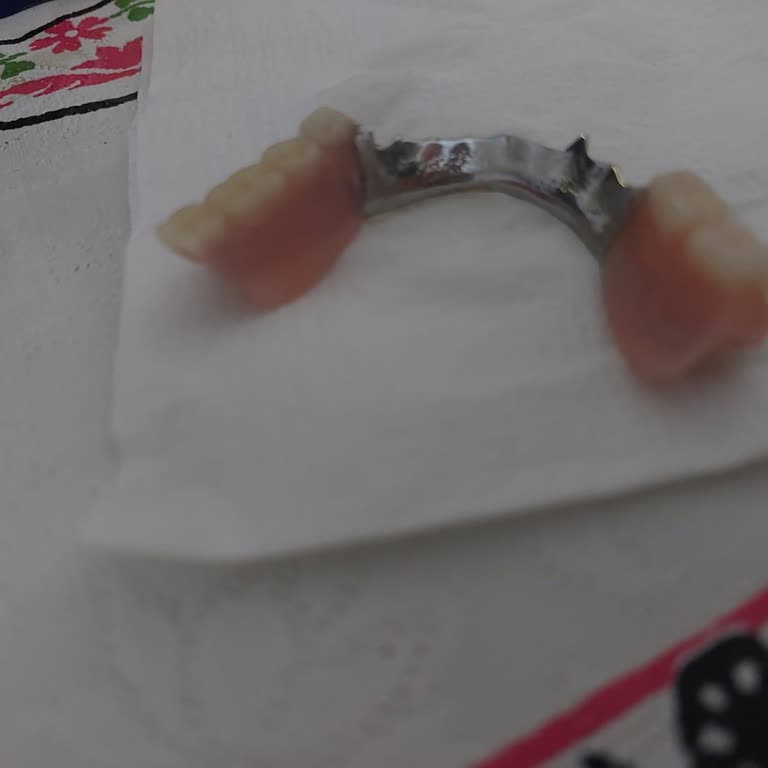 Yüzyıl Pendik Hastanesi Yüzyıl Hastanesi Diş Yapamıyor!