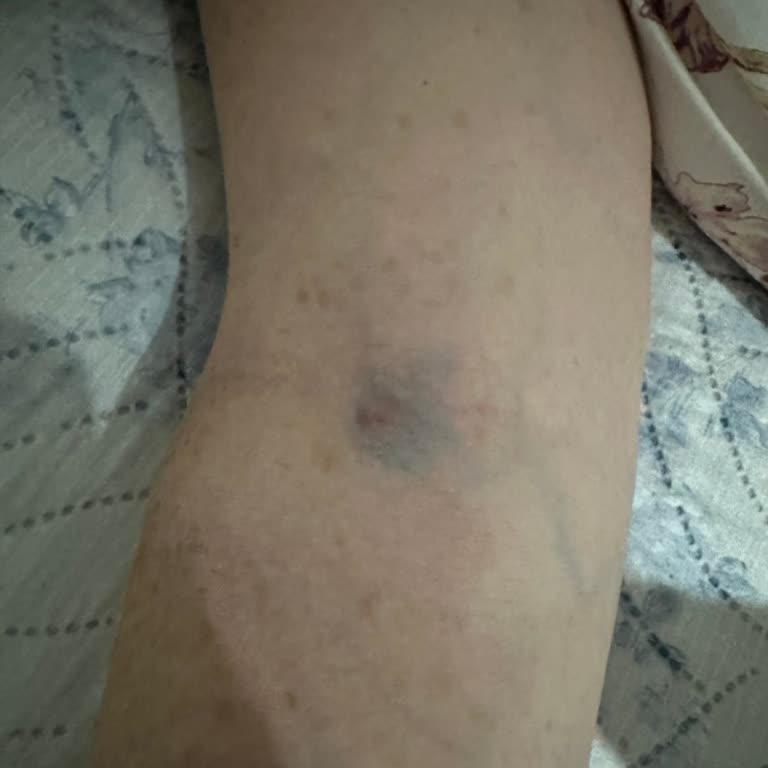 Kepez Devlet Hastanesi Hemşire Tecrübesi Yok