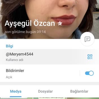 Bitforex Bit Forex Paramı Vermiyor Hesabımda 19 Bin Tl Param Var Alamıyorum