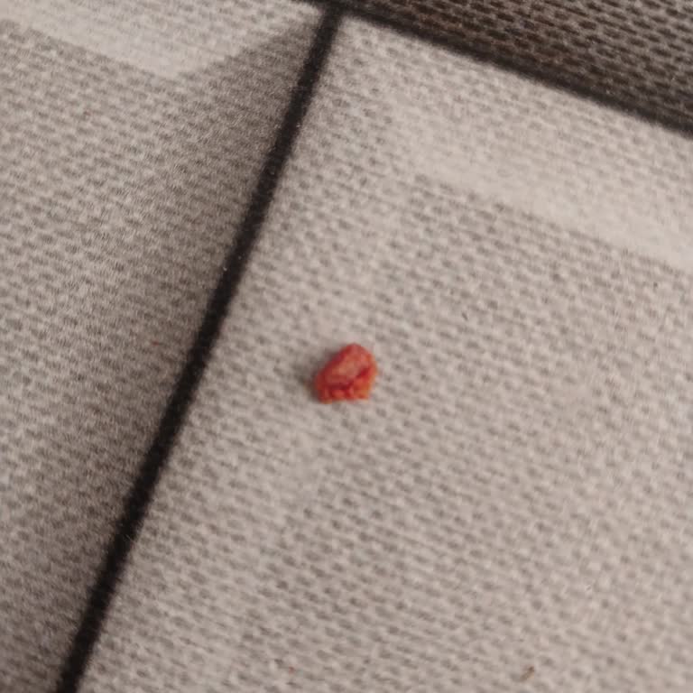 Beşler Sucuk Dilimli Sucuktan Kemik Çıktı