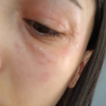 Flormar Perfect Coverage Cildimi Mahvetti