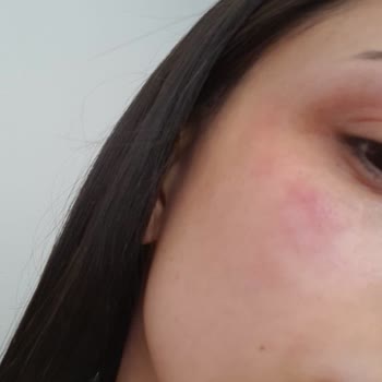 Flormar Perfect Coverage Cildimi Mahvetti