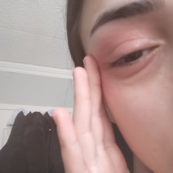 Flormar Perfect Coverage Cildimi Mahvetti