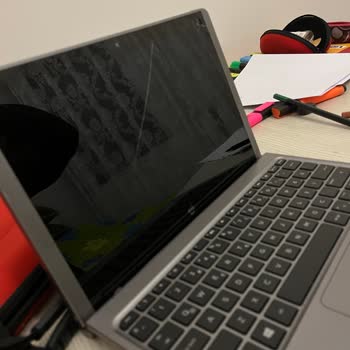 HP Yetkili Teknik Servis Aramıyor Beni Neden?