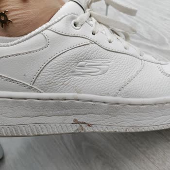 Skechers Ayakkabımın Tabanı Çöktü
