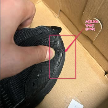 Skechers Üretmiş Olduğu Ürünün Arkasında Durmuyor