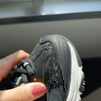 Skechers Ayakkabının Yırtılması Ve Markanın Sorunu Kabul Etmemesi