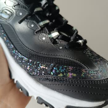 Skechers Ayakkabının Yırtılması Ve Markanın Sorunu Kabul Etmemesi