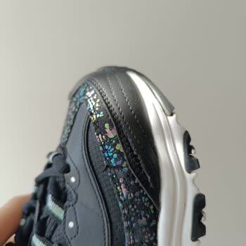 Skechers Ayakkabının Yırtılması Ve Markanın Sorunu Kabul Etmemesi