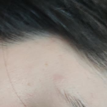 L'Oreal Paris Elseve Glikolik Asitli Şampuan Sorunu