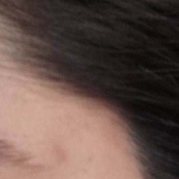 L'Oreal Paris Elseve Glikolik Asitli Şampuan Sorunu