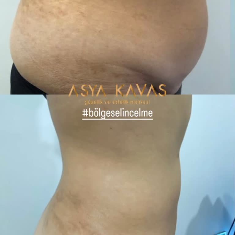 Asya Kavas Beauty Palace Yok Böyle Bir Şey