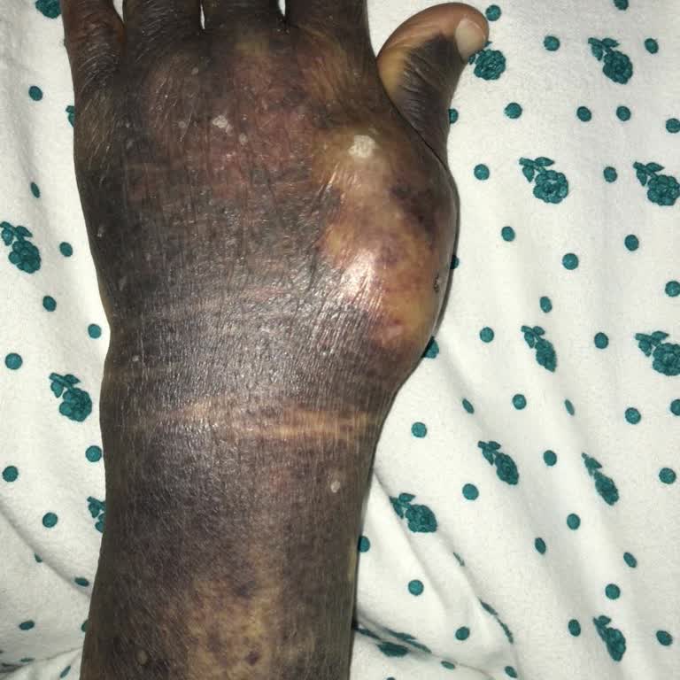 Özel Erciyes Hastanesi Hastanede Yaşanan Tıbbi Sorunlar