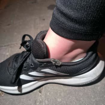 Adidas Ayakkabı Hatalı Ürün