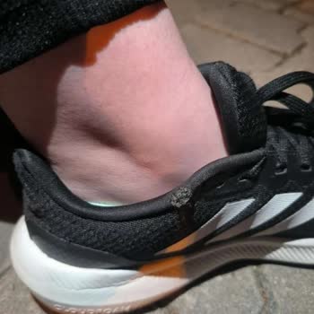 Adidas Ayakkabı Hatalı Ürün