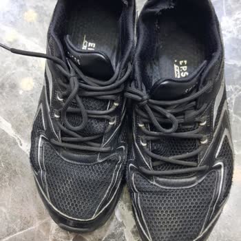 Skechers Denen Marka Resmen Malının Arkasında Durmuyor