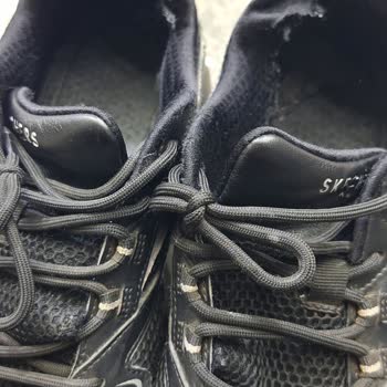 Skechers Denen Marka Resmen Malının Arkasında Durmuyor