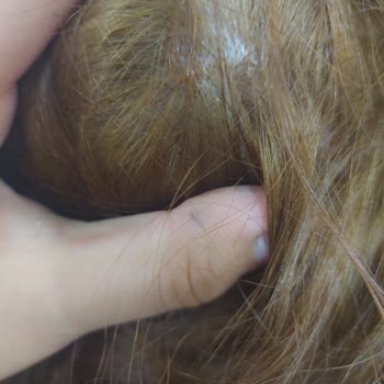 Garnier Saç Boyası Saç Derimi Komple Yaktı Açıdan Duramıyorum