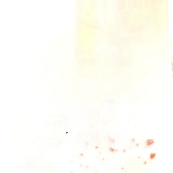 Aris Güzellik Merkezleri Bursa Güzellik Merkezinde İğneli Epilasyon Deneyimi