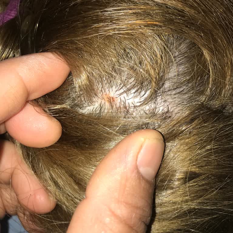 Urban Care Toniği Saç Derimde Sorunlara Yol Açtı