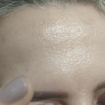 Hera Altın Oran Pigmentleri Kızıllık Yapıyor