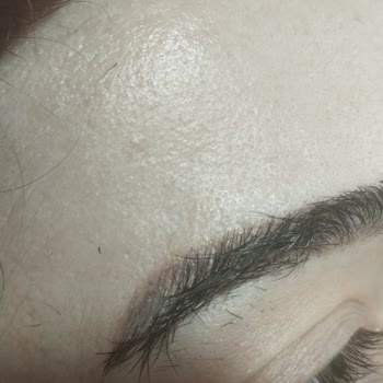 Hera Altın Oran Pigmentleri Kızıllık Yapıyor