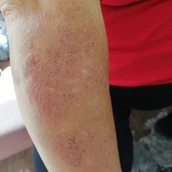 Epi Center Güzellik Epicenter Kızılay Karanfil Sokak