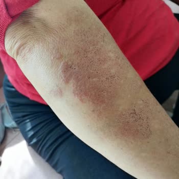 Epi Center Güzellik Epicenter Kızılay Karanfil Sokak