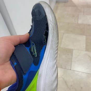 3 Ayda Yırtılan Skechers Ayakkabı Ve Boyner'in İlgisizliği