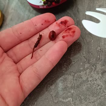 ebebek Hamm Karadut Özü